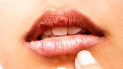 آنچه دهان دیابتی ها را خشک میکند