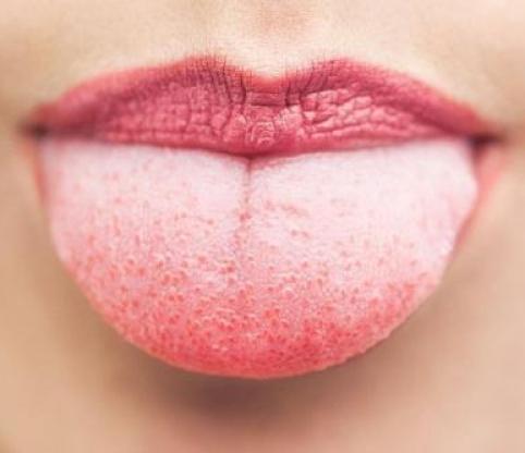 شرایط زبان مان درباره سلامتی ما چه می گوید؟