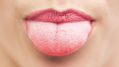 شرایط زبان مان درباره سلامتی ما چه می گوید؟