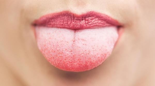 شرایط زبان مان درباره سلامتی ما چه می گوید؟