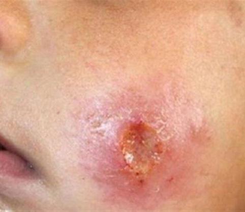 پاسخ به 9 پرسش رایج درباره سالک